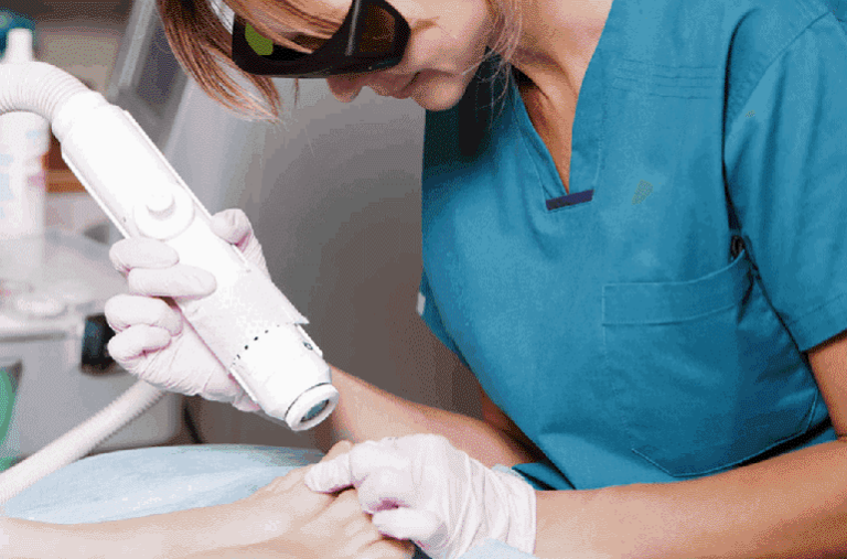 Laser Toenail Fungus Removal